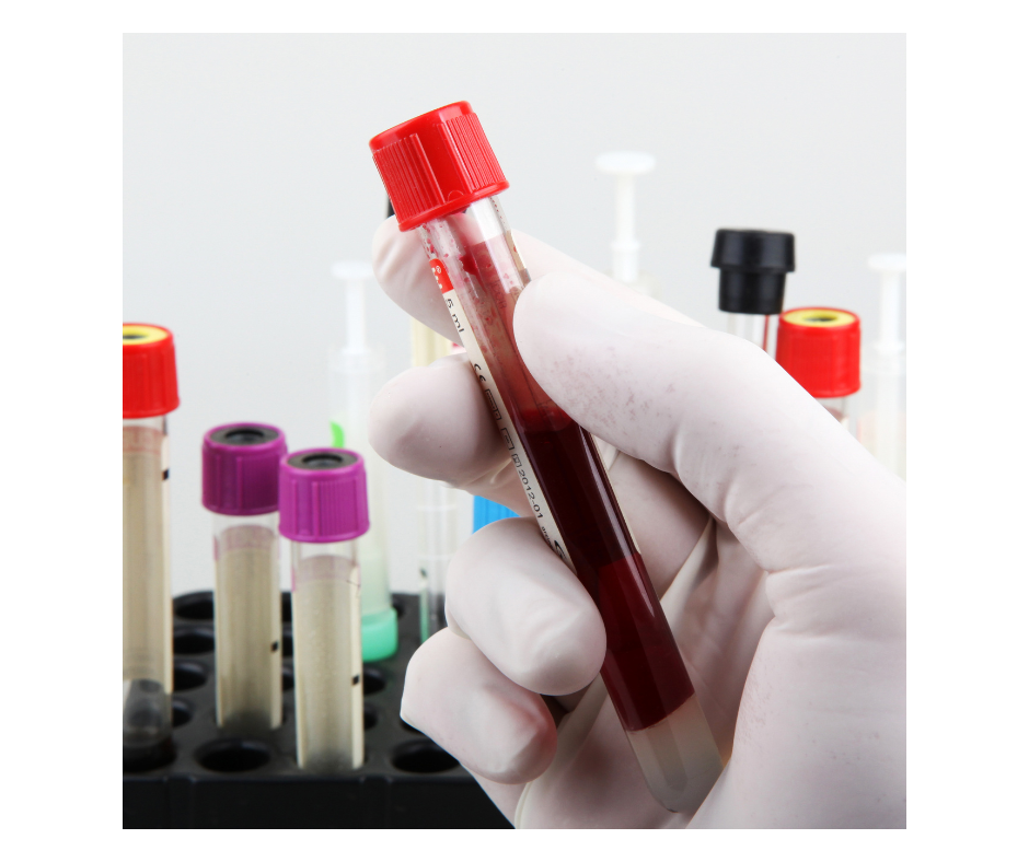 Interpret bloodwork through functional medicine lens with Dr. Krista Coombs